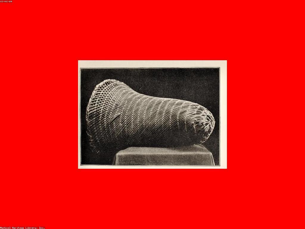 អភិវឌ្ឍន៍និងអត្ថប្រយោជន៍នៃដំណឹងនិងព្រឹត្តិការ